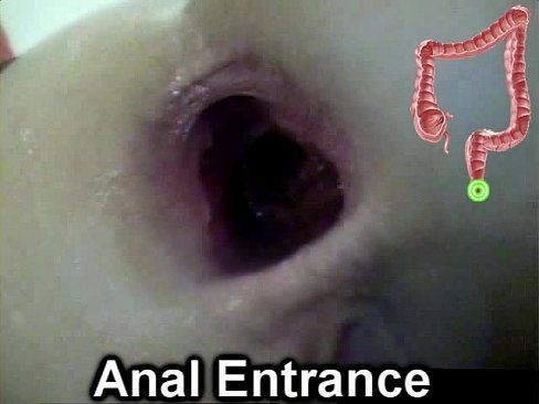 Chubby Anal Poster - Colon deep anal - Porn pictures. Comments: 4